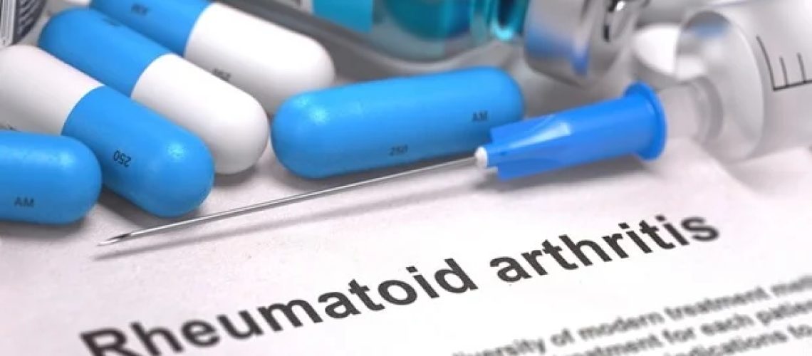 תרכובת טבעית אובאקולקטון מראה פוטנציאל טיפולי לדלקת מפרקים שגרונית